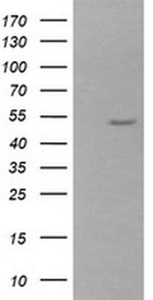 ZSCAN21 Antibody in Western Blot (WB)