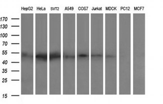 ZSCAN21 Antibody in Western Blot (WB)