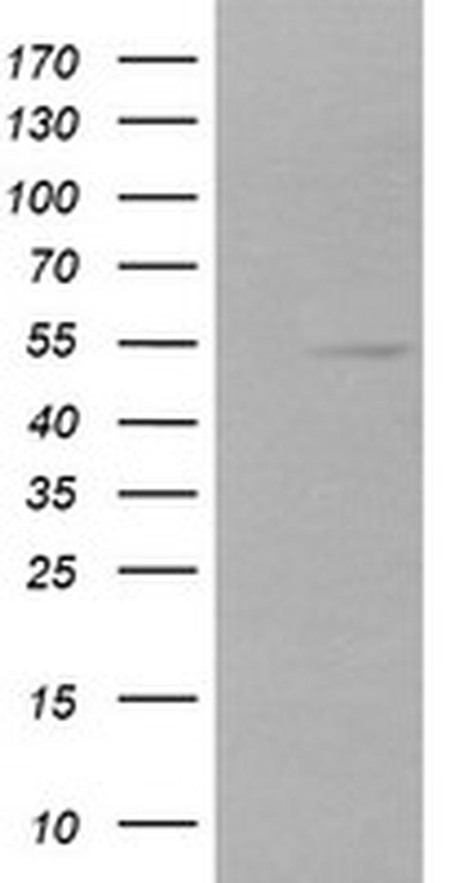 ZSCAN21 Antibody in Western Blot (WB)