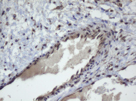 ZSCAN4 Antibody in Immunohistochemistry (Paraffin) (IHC (P))