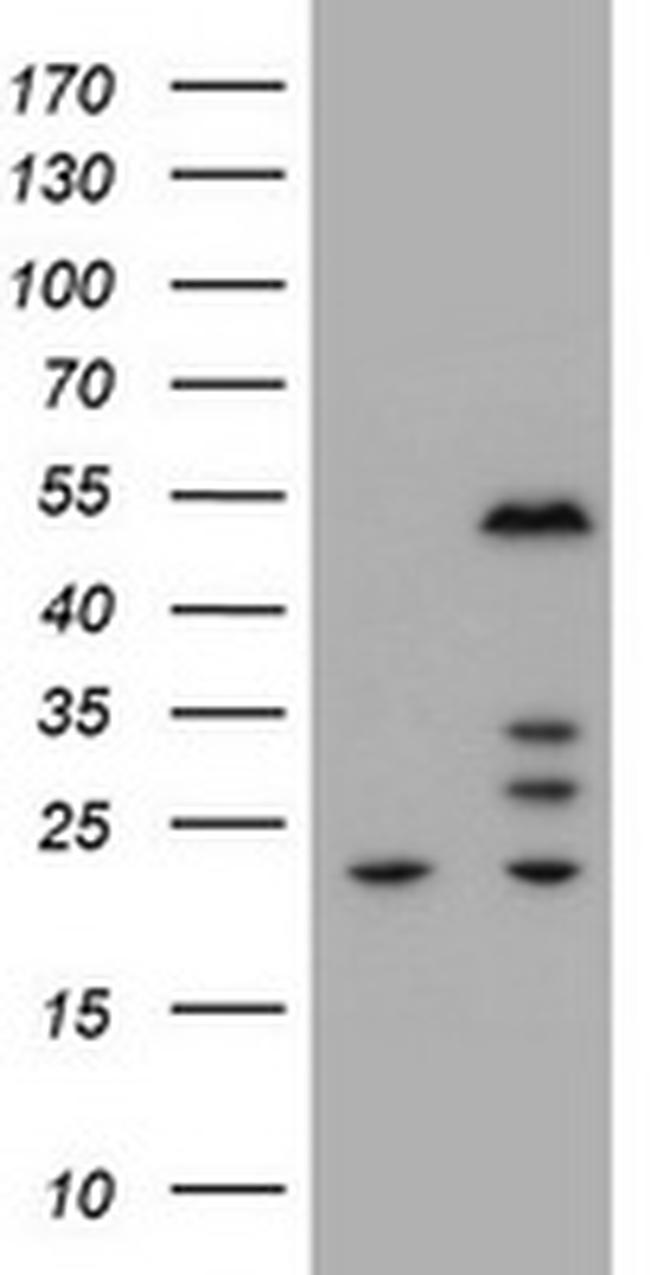 ZSCAN4 Antibody in Western Blot (WB)