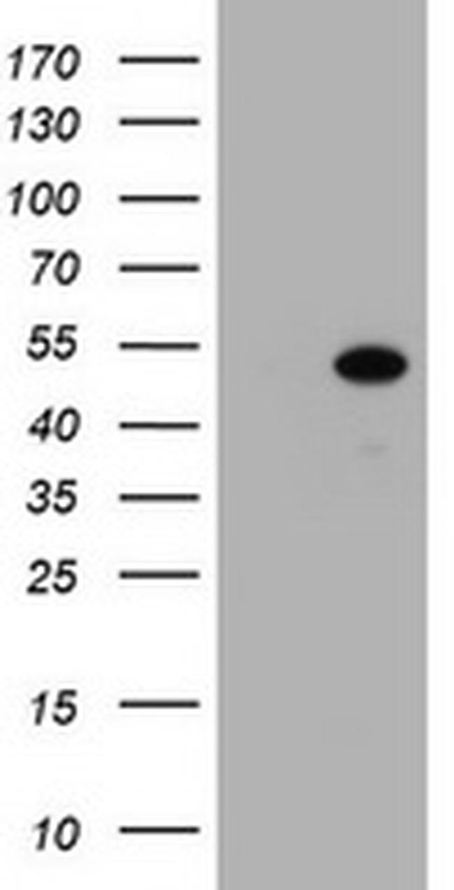 ZSCAN4 Antibody in Western Blot (WB)