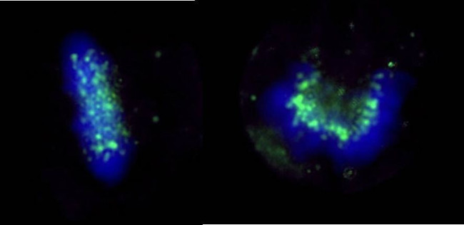 ZWINT-1 Antibody in Immunocytochemistry (ICC/IF)