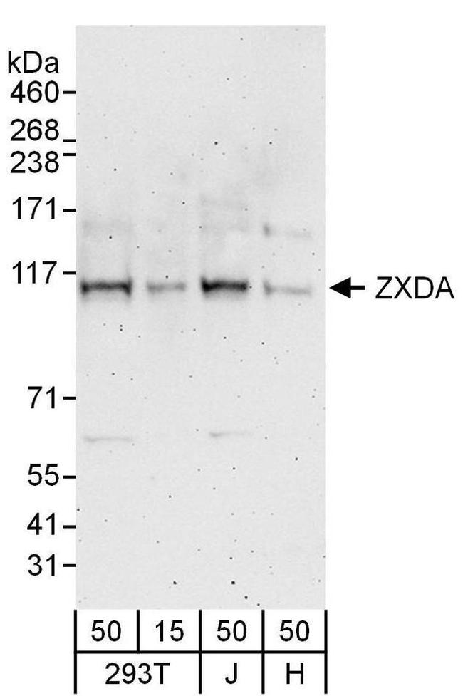 ZXDA/ZXDB Antibody in Western Blot (WB)