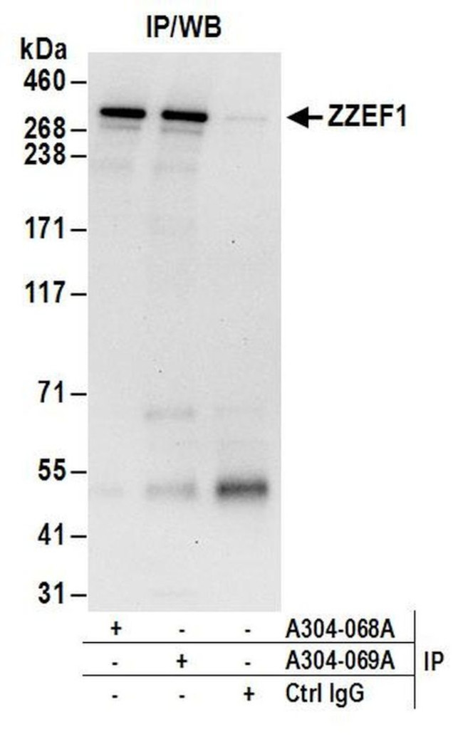 ZZEF1 Antibody in Immunoprecipitation (IP)