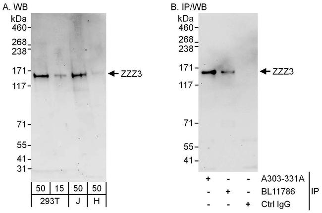 ZZZ3 Antibody in Western Blot (WB)