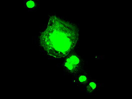 aFGF Antibody in Immunocytochemistry (ICC/IF)