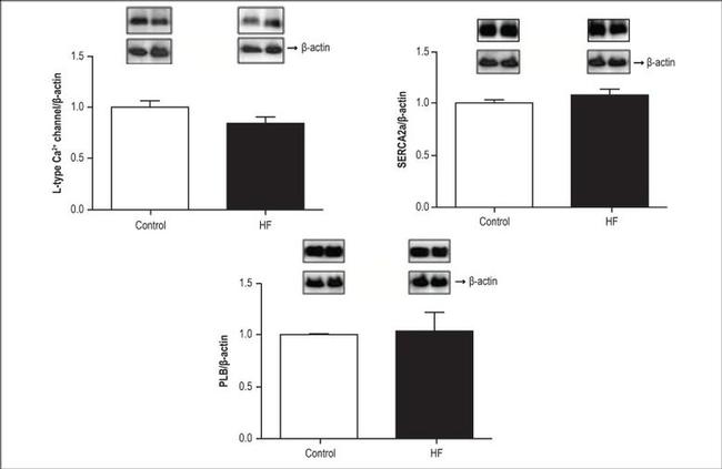 Phospholamban Antibody in Western Blot (WB)