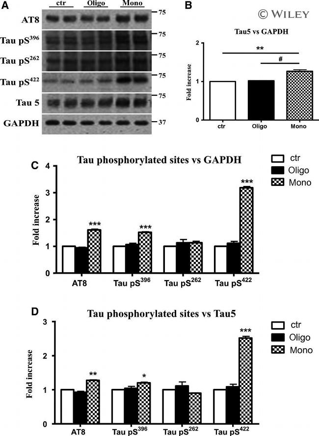 Phospho-Tau (Ser396) Antibody in Western Blot (WB)