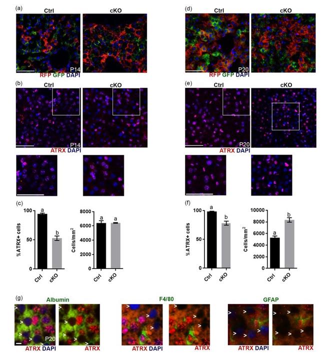 GFP Antibody in Immunohistochemistry (IHC)