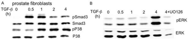 SMAD3 Antibody in Western Blot (WB)