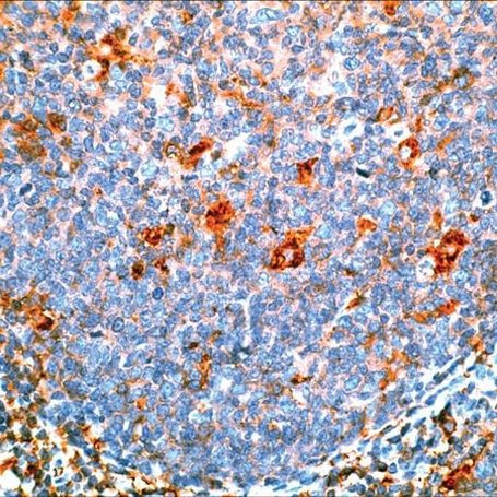 SERPINA3 Antibody in Immunohistochemistry (Paraffin) (IHC (P))