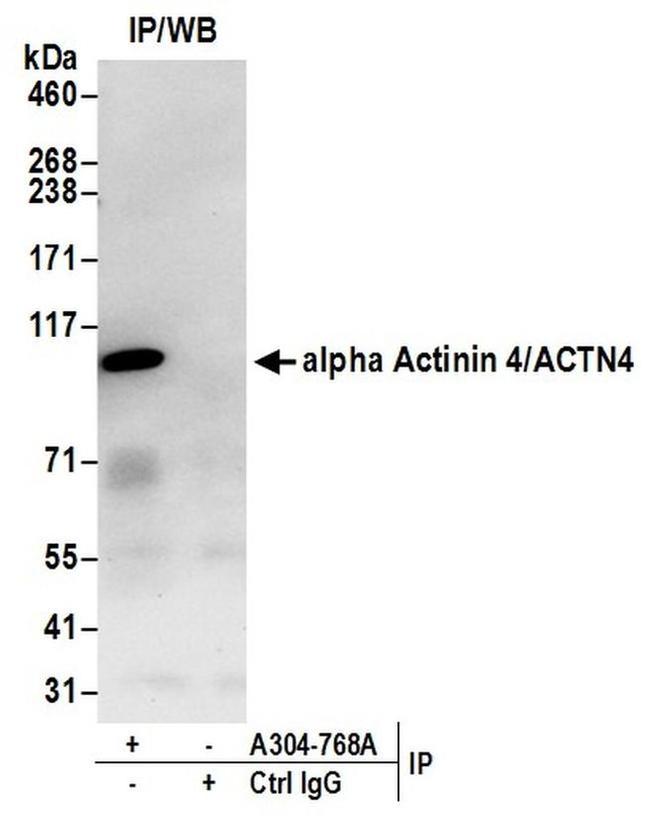 alpha Actinin 4/ACTN4 Antibody in Western Blot (WB)