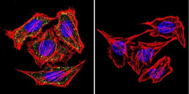 alpha Adaptin Antibody in Immunocytochemistry (ICC/IF)