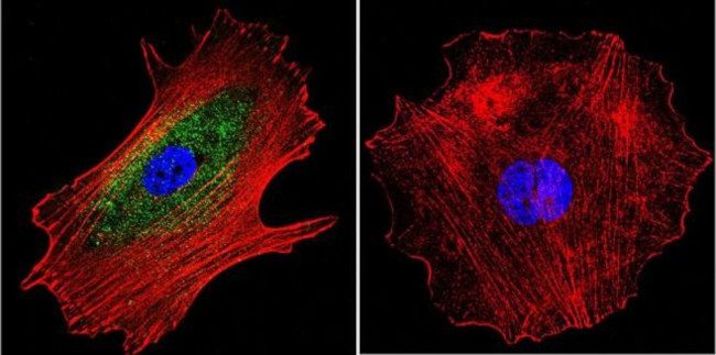 alpha Adaptin Antibody in Immunocytochemistry (ICC/IF)