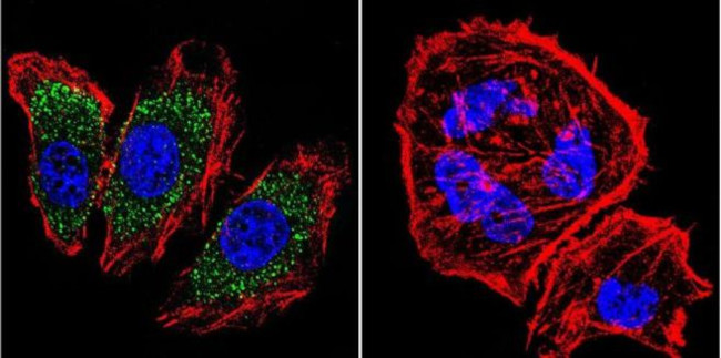 alpha Adaptin Antibody in Immunocytochemistry (ICC/IF)