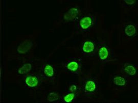 alpha-actinin (Actinin alpha 1) Antibody in Immunocytochemistry (ICC/IF)