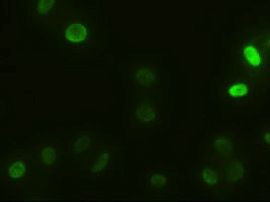 alpha-actinin (Actinin alpha 1) Antibody in Immunocytochemistry (ICC/IF)