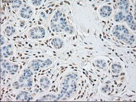 alpha-actinin (Actinin alpha 1) Antibody in Immunohistochemistry (Paraffin) (IHC (P))