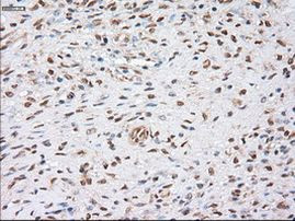 alpha-actinin (Actinin alpha 1) Antibody in Immunohistochemistry (Paraffin) (IHC (P))