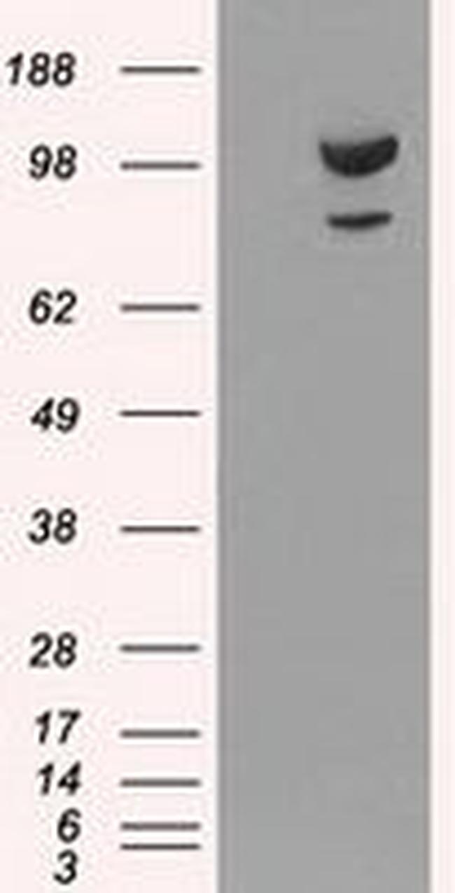 alpha-actinin (Actinin alpha 1) Antibody in Western Blot (WB)