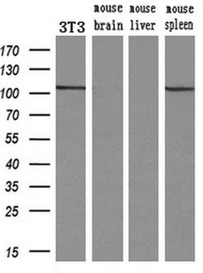 alpha-actinin (Actinin alpha 1) Antibody in Western Blot (WB)