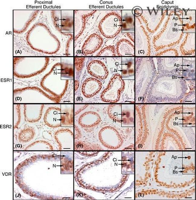 VDR Antibody in Immunohistochemistry (IHC)