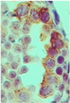 TLR3 Antibody in Immunohistochemistry (IHC)