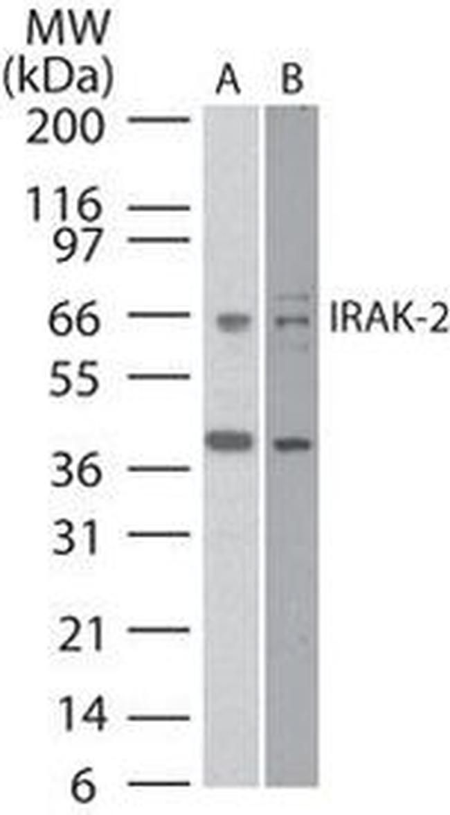 IRAK2 Antibody in Western Blot (WB)