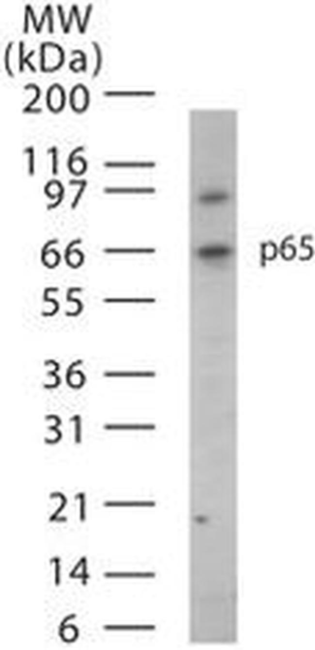 NFkB p65 Antibody in Western Blot (WB)