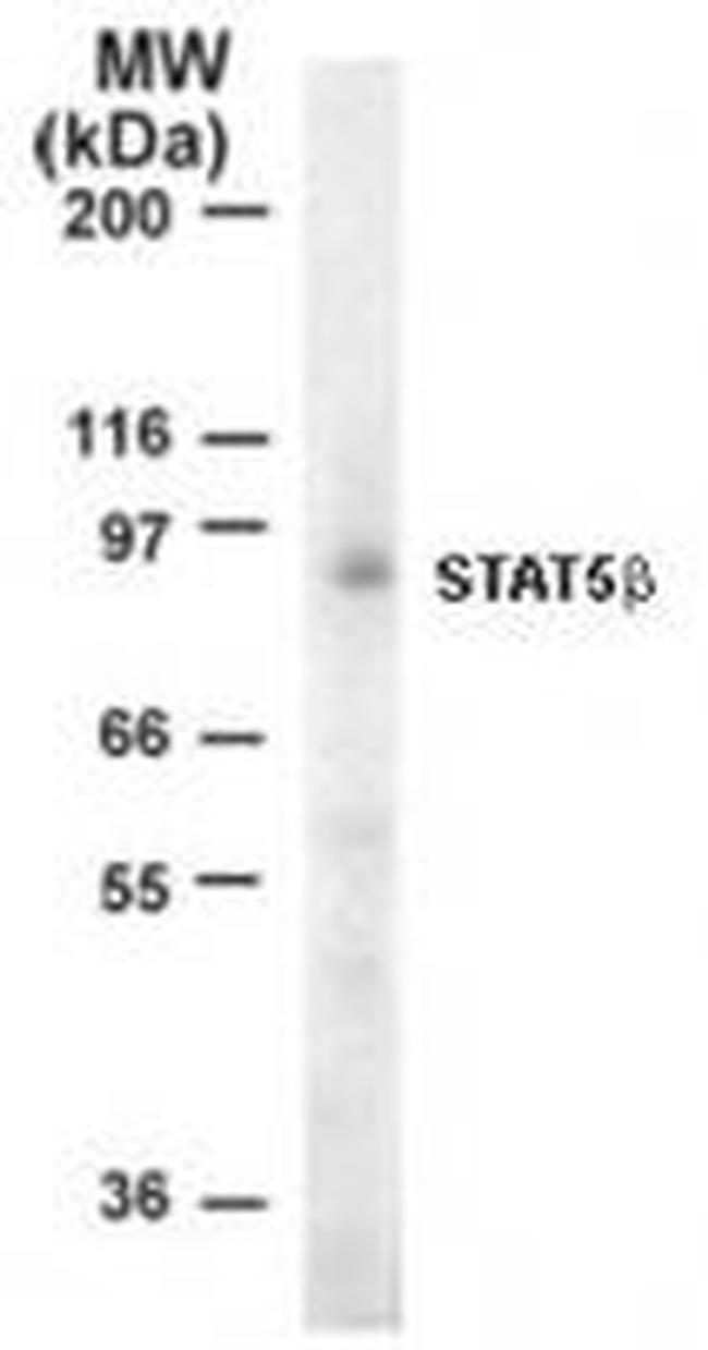 STAT5 beta Antibody in Western Blot (WB)