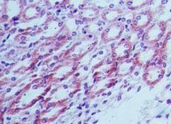 TLR4 Antibody in Immunohistochemistry (Paraffin) (IHC (P))