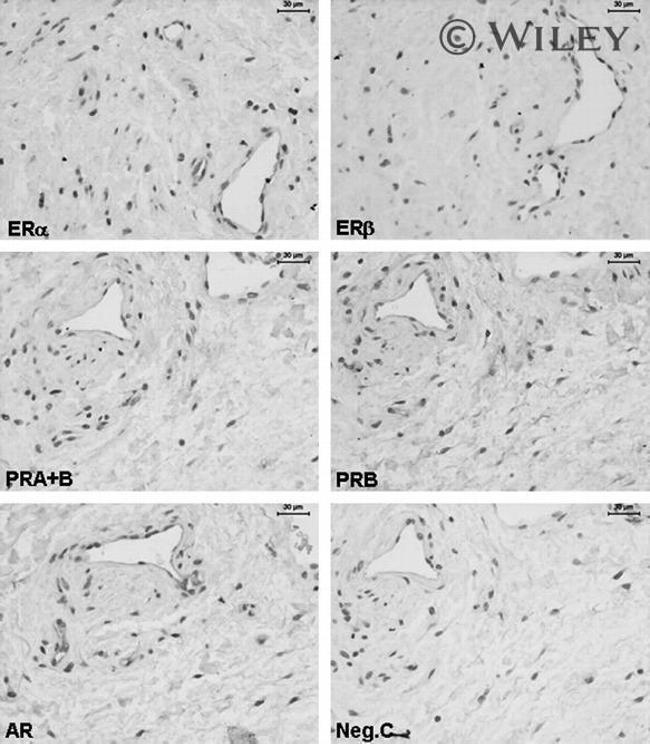 Progesterone Receptor Antibody in Immunohistochemistry (IHC)