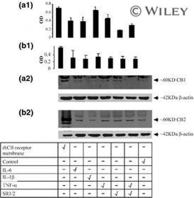 CNR2 Antibody in Western Blot (WB)