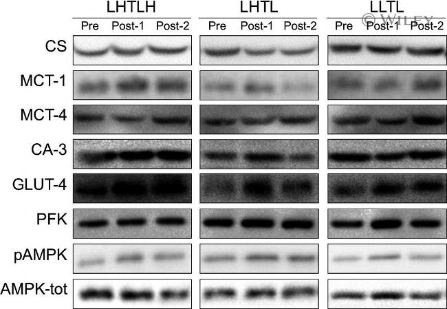 GLUT4 Antibody in Western Blot (WB)