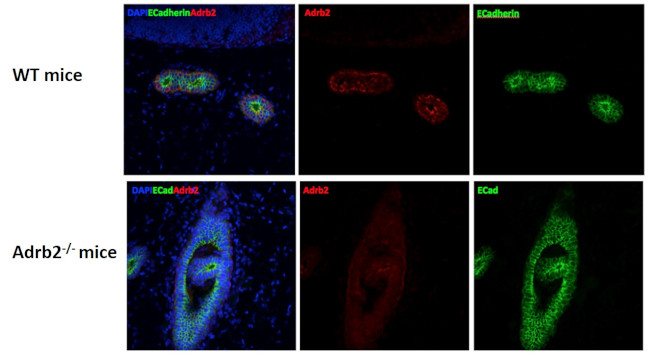 Rabbit IgG (H+L) Highly Cross-Adsorbed Secondary Antibody in Immunocytochemistry (ICC/IF)