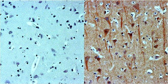 beta-3 Tubulin Antibody in Immunohistochemistry (Paraffin) (IHC (P))