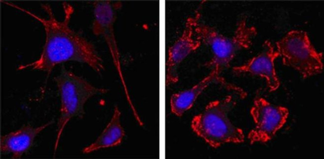 beta Actin Antibody in Immunocytochemistry (ICC/IF)