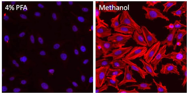 beta Actin Antibody in Immunocytochemistry (ICC/IF)