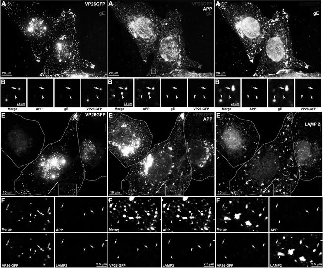 beta Amyloid Antibody in Immunocytochemistry (ICC/IF)