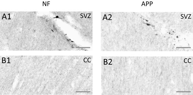 beta Amyloid Antibody in Immunohistochemistry (IHC)