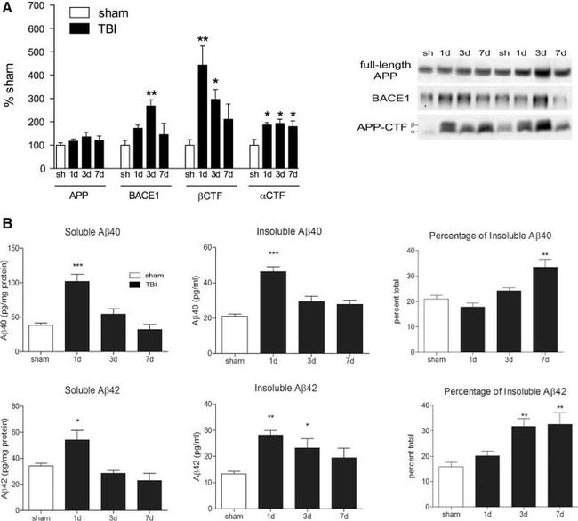 beta Amyloid Antibody in Western Blot (WB)