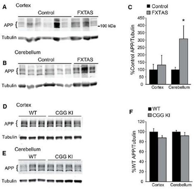 beta Amyloid Antibody in Western Blot (WB)