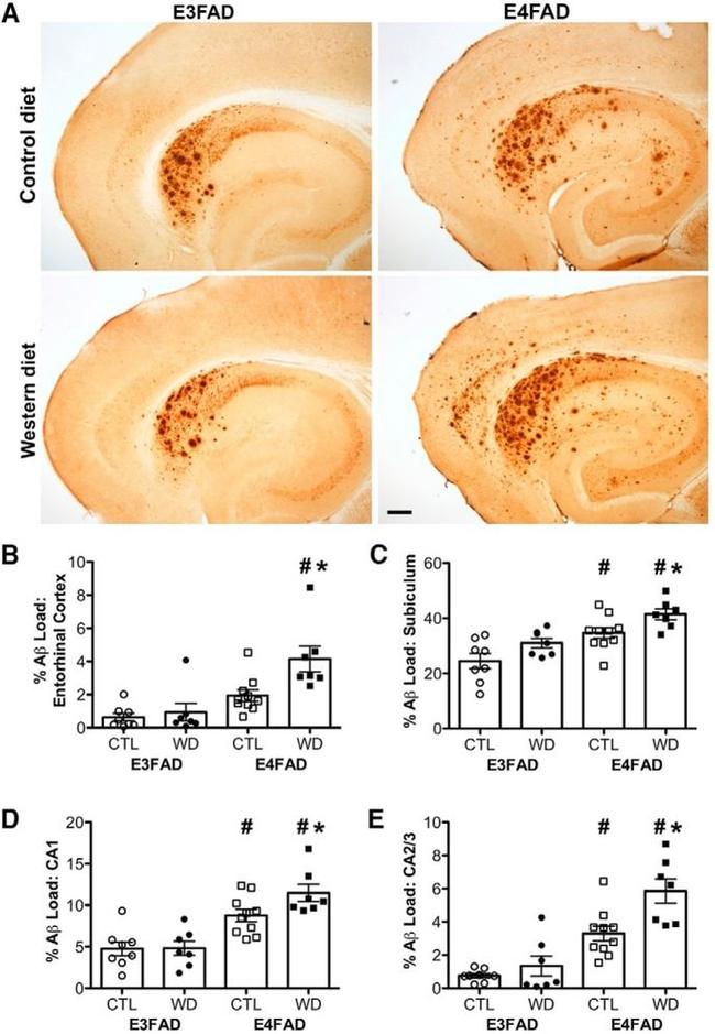 beta Amyloid Antibody in Immunohistochemistry (IHC)