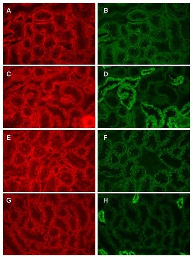 beta Catenin Antibody in Immunohistochemistry (Frozen) (IHC (F))