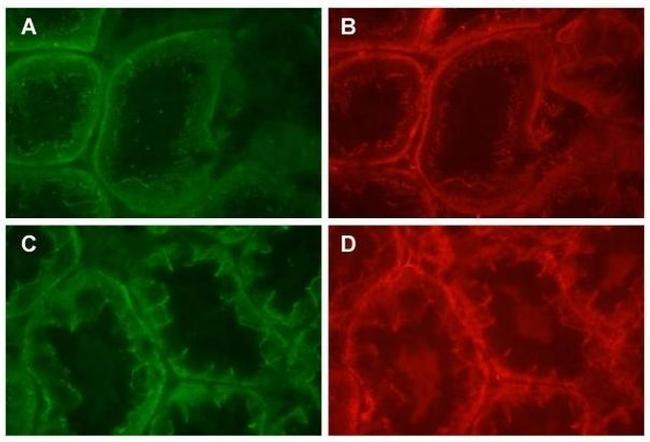 beta Catenin Antibody in Immunohistochemistry (Frozen) (IHC (F))