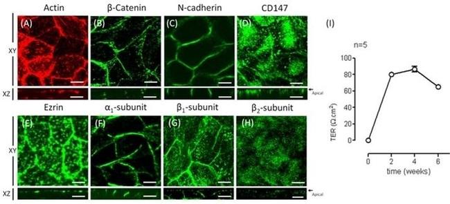 beta Catenin Antibody in Immunocytochemistry (ICC/IF)