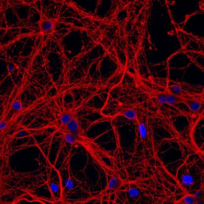 beta-3 Tubulin Antibody in Immunocytochemistry (ICC/IF)