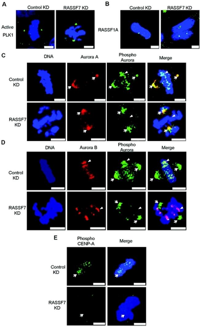 RASSF1A Antibody in Immunocytochemistry (ICC/IF)