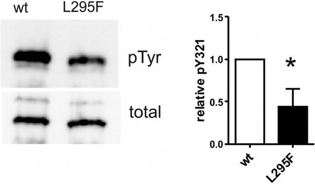 Phospho-HIPK2 (Tyr361) Antibody in Western Blot (WB)